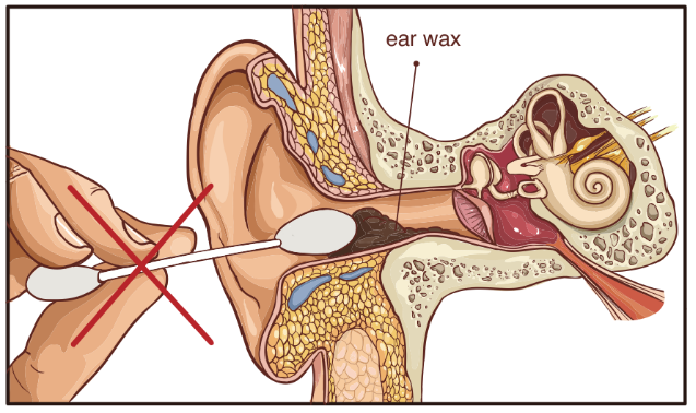 drawing showing the inner parts of the ear and ear wax